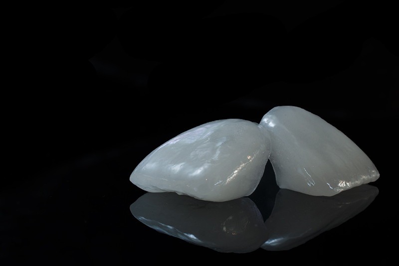 ラミネートベニア