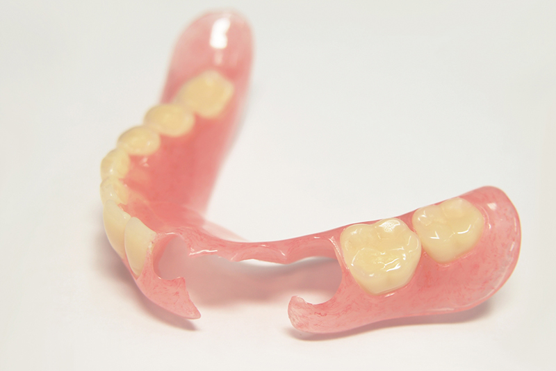 バネの無い入れ歯