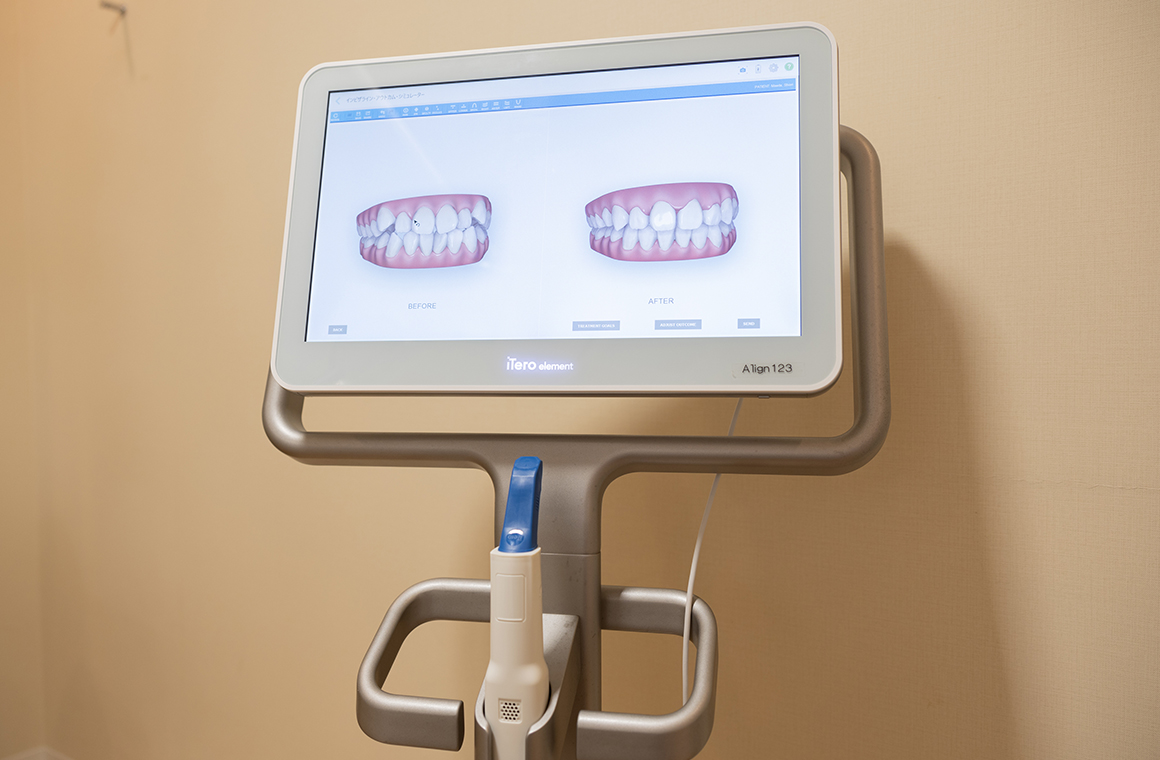 アイテロエレメント2