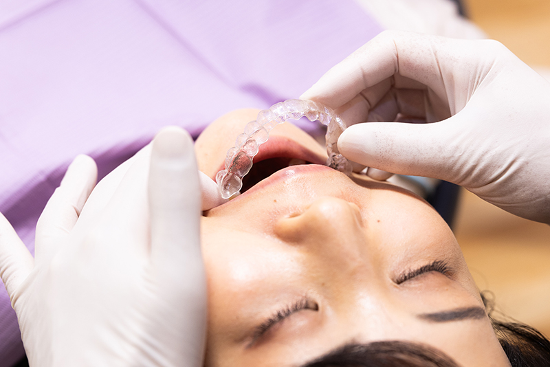 インビザライン