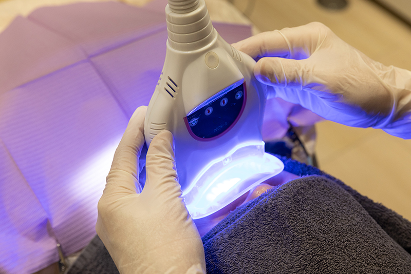 ホワイトニング