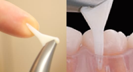 痛みに配慮した歯周病治療