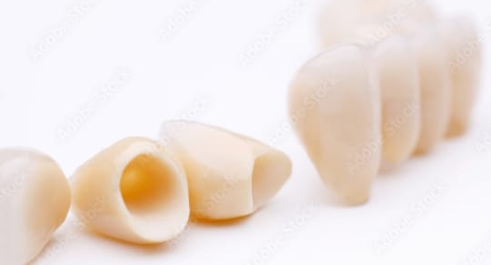 審美 セラミック治療